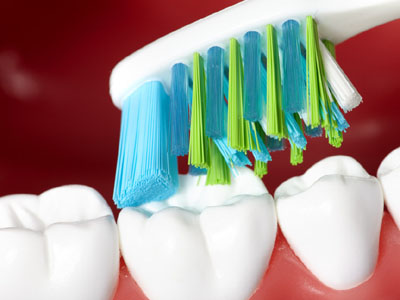牙隱裂引起長期牙痛嗎