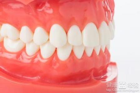 牙齒矯正的最佳年齡和價格是多少?