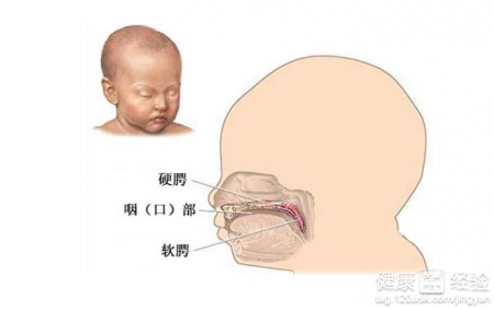 第1步