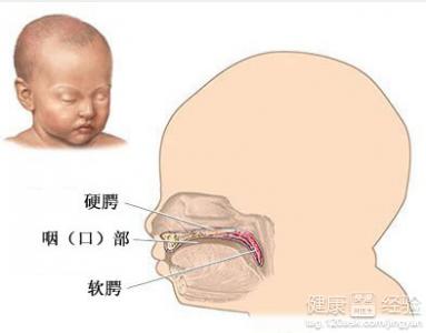 唇腭裂修復後可以做哪些嘴部動作