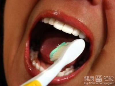 口腔潰瘍期間刷牙不疼的小技巧
