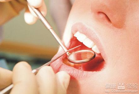 口腔潰瘍典型症狀有哪些