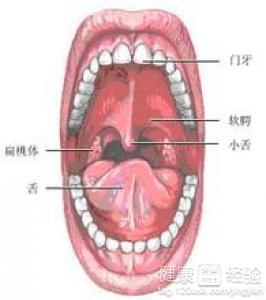 口腔潰瘍怎麼辦能治好