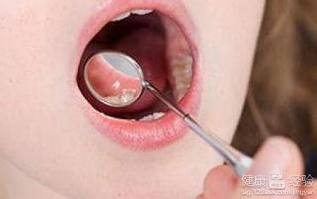 口腔潰瘍經常發作怎麼辦