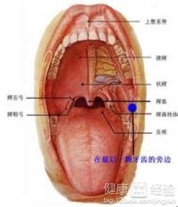 口腔潰瘍治療方法精選