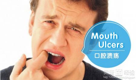 口腔潰瘍時頸部淋巴結腫痛正常嗎？
