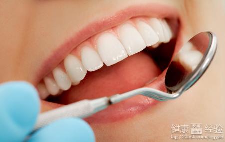 口腔潰瘍有哪些治療方法。