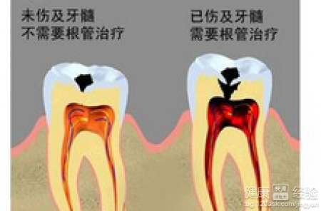 如何防治孩子乳牙齲齒