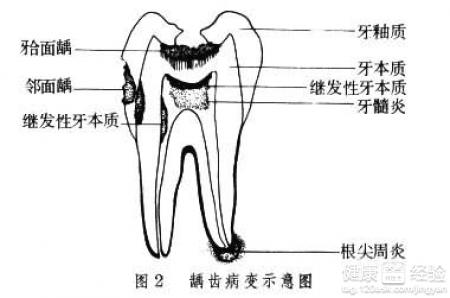 第1步