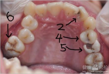 第1步