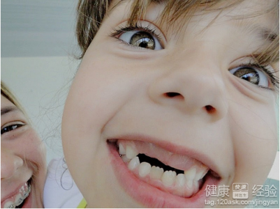兒童齲齒換牙要注意什麼