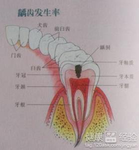 第2步