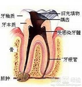 第2步