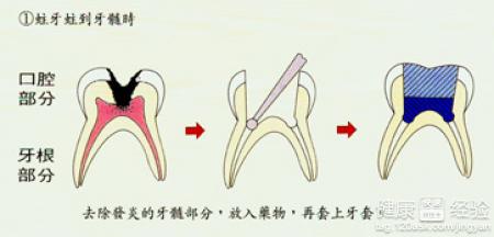 第3步