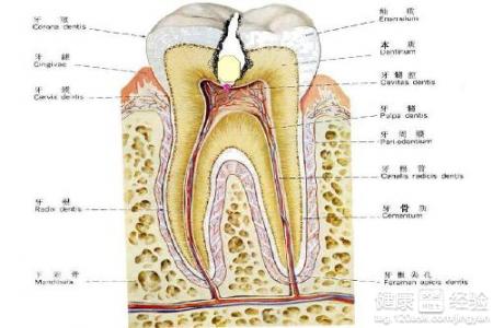 齲齒已經到侵蝕到牙神經的地步了該怎麼辦