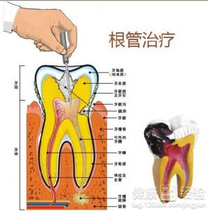 第3步