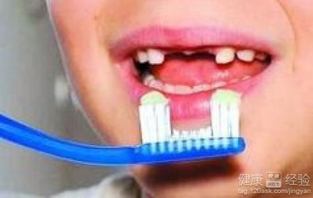 如何有效預防孩子齲齒