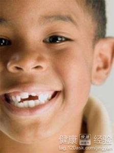 怎樣預防孩子蛀牙