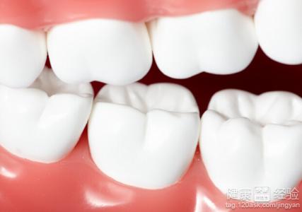 隱形牙齒矯正分類有哪些