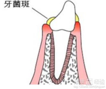 第1步