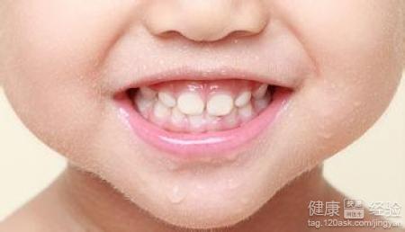 牙齒越來越黃怎麼辦