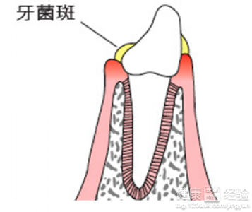 第1步