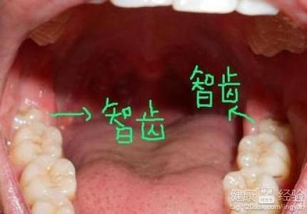 第1步