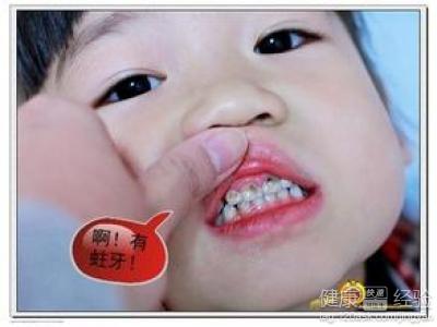 兒童乳牙有齲洞該怎麼辦