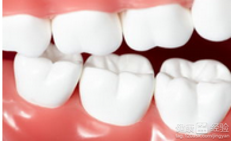 如何治療牙齒缺損