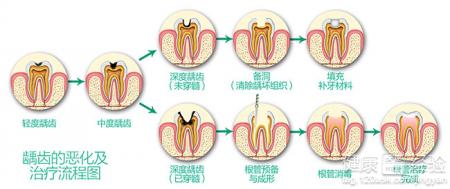 第2步