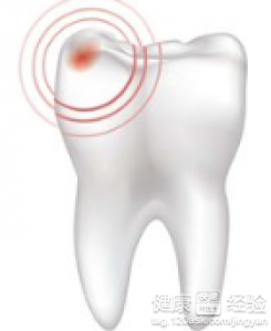 成人為什麼會經常牙痛