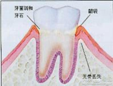 第2步