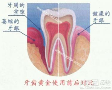 第1步