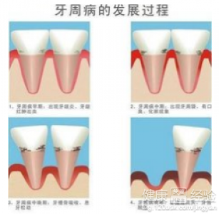 第1步