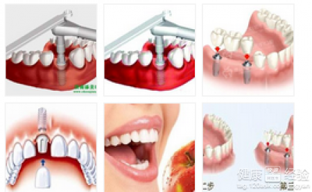 牙齒痛有什麼要注意的