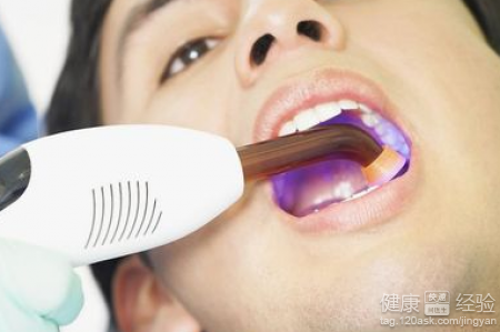 牙痛有什麼療效藥嗎