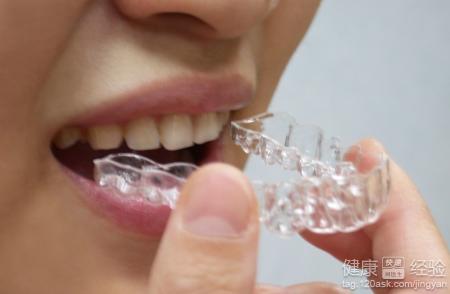 牙齒矯正器有什麼影響
