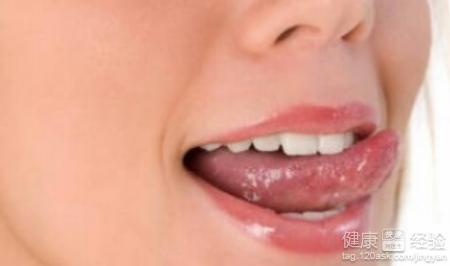 如何治療舌燥口臭