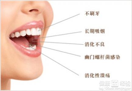 別讓口腔異味阻隔了你的人緣