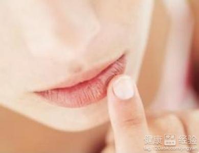 口腔干燥綜合征怎麼治療