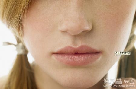 吃維生素b可以治療唇炎嗎