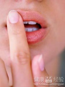 唇炎患者有經常喝水可是還是嘴巴干燥怎麼辦