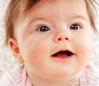嬰兒口唇炎是什麼造成的