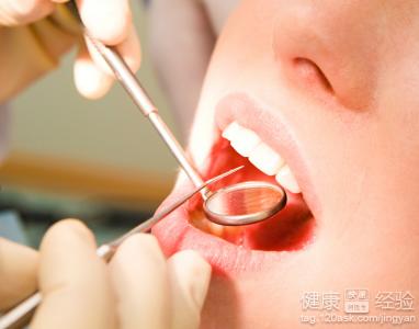 口腔潰瘍，舌炎，將近一月可以治愈嗎