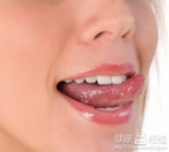 舌炎有什麼好的辦法治療