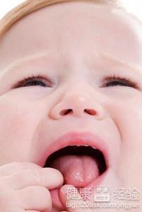 舌炎會出現什麼症狀