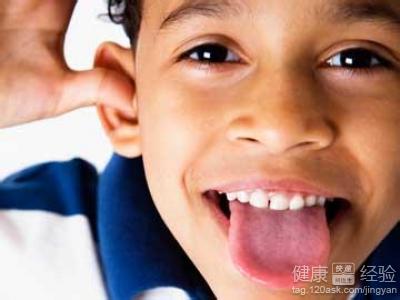 小孩舌炎怎麼辦