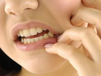 口腔潰瘍有哪些預防和保健的方法