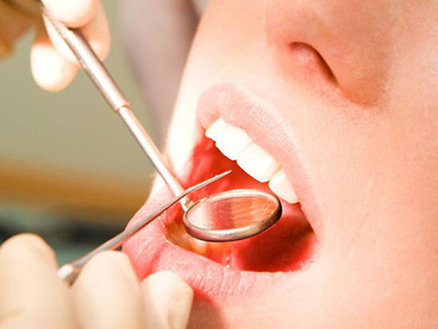 口腔潰瘍與其他疾病的區別