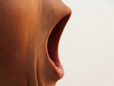 口腔潰瘍—你不得不重視的隱患！
